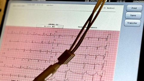 Z wizytą w Klinice Kardiochirurgii w Szpitalu Uniwersyteckim im. doktora Antoniego Jurasza w Bydgoszczy. Fot. Izabela Langner/PR PiK