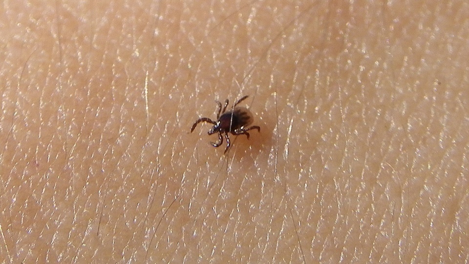Osoby z podejrzeniem boreliozy powinny szukać pomocy u specjalistów w zakresie leczenia chorób zakaźnych.. Fot. freeimages
