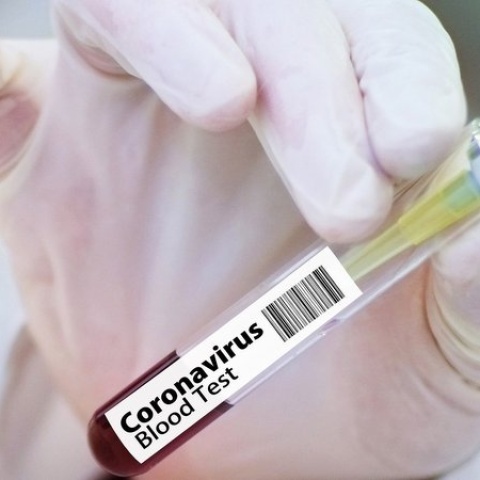 Koronawirus w Polsce: 12430 nowych przypadków zakażeń 1091 w Kujawsko-Pomorskiem