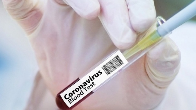 Raport Ministerstwa Zdrowia: 119 nowych przypadków koronawirusa