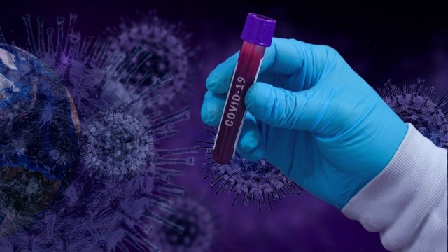 Testy na koronawirusa: kolejny szpital je wykonuje. To laboratorium w Juraszu