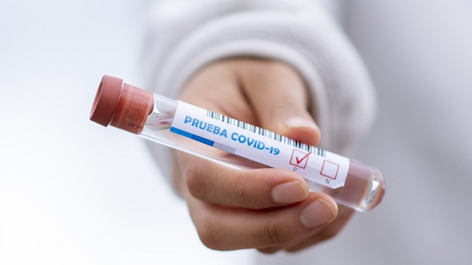 Śląskie, małopolskie to województwa z największą liczbą pozytywnych testów na koronawirusa w raporcie MZ z 16 lipca./fot. Pixabay