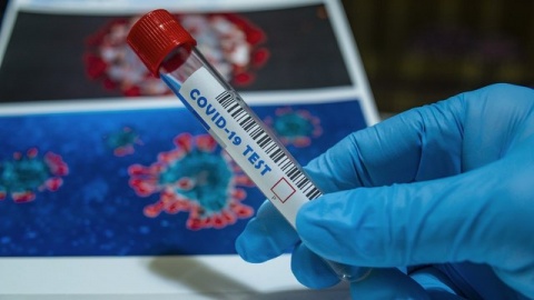 13,5 tys. nowych zakażeń koronawirusem w kraju. Zmarło 126 osób