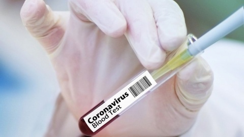 104 nowe zakażenia koronawirusem w kraju, sześć w Kujawsko-Pomorskiem