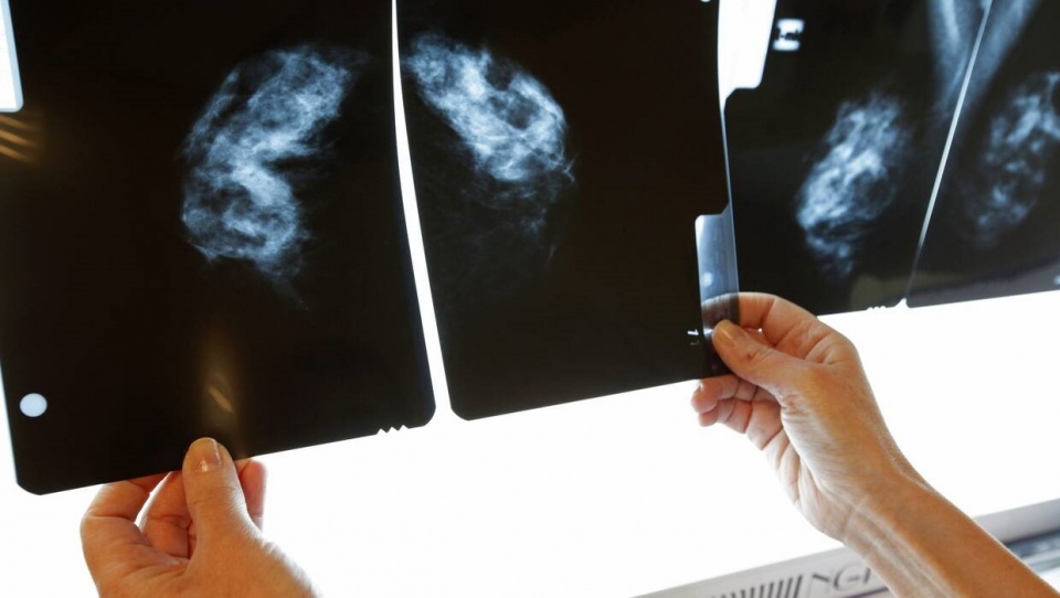 Kobiety chore na raka piersi dowiadują się o tym za późno. Pierwsza faza choroby daje szansę na całkowite wyleczenie./fot. PAP/Artur Reszko