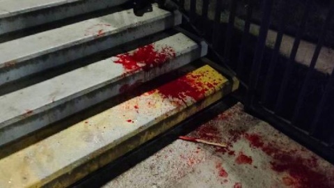 27-letni bandyta dotkliwie pobił i skopał 74-letniego mężczyznę na kładce przy ul. Fordońskiej w Bydgoszczy/fot. materiały policji