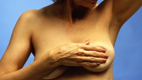 O rekonstrukcji piersi po przebytym nowotworze. Warsztaty w bydgoskim Centrum Onkologii