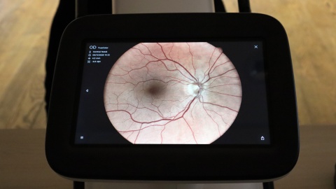 W Bydgoszczy wszyscy zainteresowani mogli skorzystać z bezpłatnych badań przesiewowych wzroku z wykorzystaniem sztucznej inteligencji/fot. Tatiana Adonis