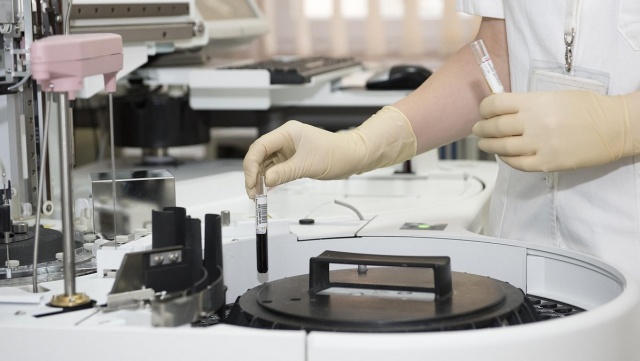 U jednego z pracowników obozu w Pile wykryto gronkowca. Czekają na wyniki badań lodów