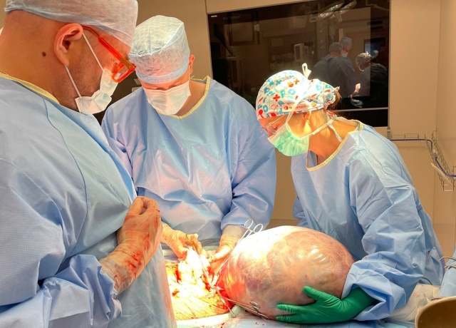 Gigantyczny guz jajnika usunęli mieszkance regionu onkolodzy z Bydgoszczy [zdjęcia]