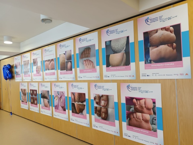 Podolog stawia na nogi Specjaliści od stóp na branżowej konferencji w Bydgoszczy