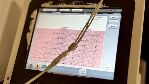 Jedna z najnowocześniejszych kardiochirurgicznych sal operacyjnych w Europie jest w bydgoskim szpitalu Jurasza/Fot. Izabela Langner