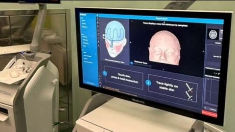 Pierwszy taki robot operacyjny w regionie. Ma go Szpital we Włocławku