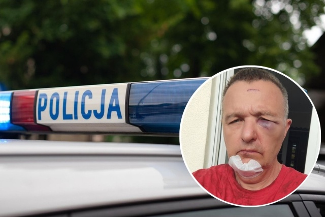 Po imprezie w Łochowie ktoś pobił sołtysa, radnego gminy i prezesa koła gospodyń wiejskich
